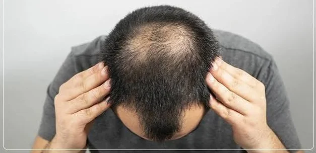 Hair Loss Consultation and Treatment