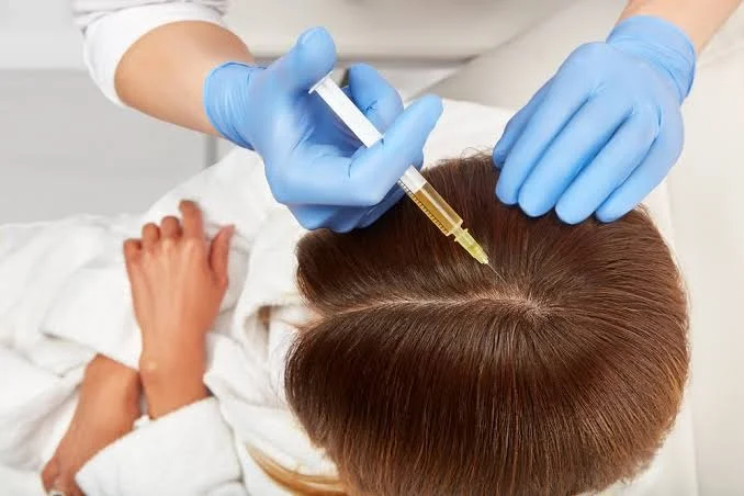 Platelet-Rich Plasma Hair Therapy
