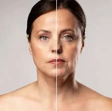 Skin Tightening Treatment
